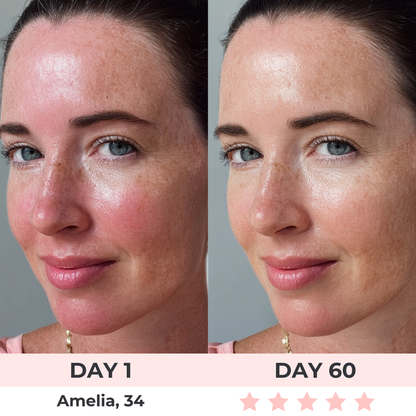 Nu Vibe™ - LED Face Mask